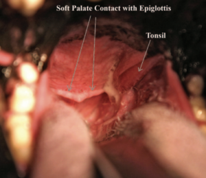 Enlarged tonsils
